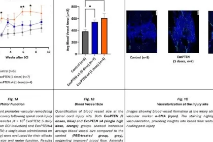 Nurexone (NRX) Reports Breakthrough in Exosomal Technology, Enhancing Healing Potential for Diverse Medical Applications